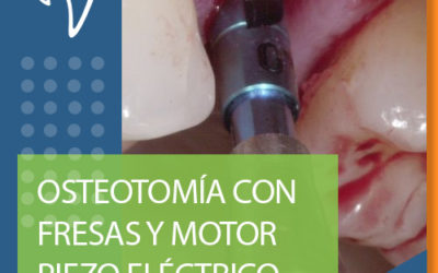 B09 OSTEOTOMÍA CON FRESAS Y MOTOR PIEZO ELÉCTRICO