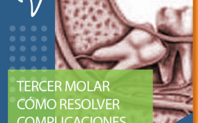 H06 TERCER MOLAR CÓMO RESOLVER COMPLICACIONES