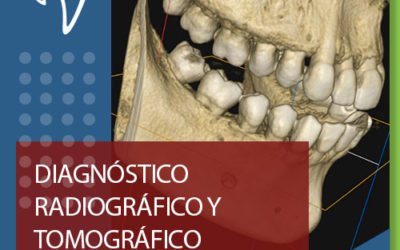 D04 DIAGNÓSTICO RADIOGRÁFICO Y TOMOGRÁFICO